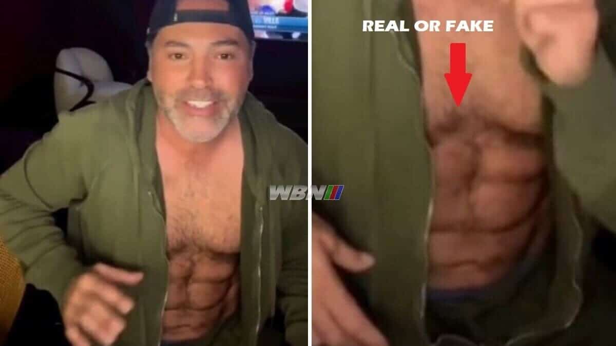 Oscar De La Hoya fake ab implants ab etching